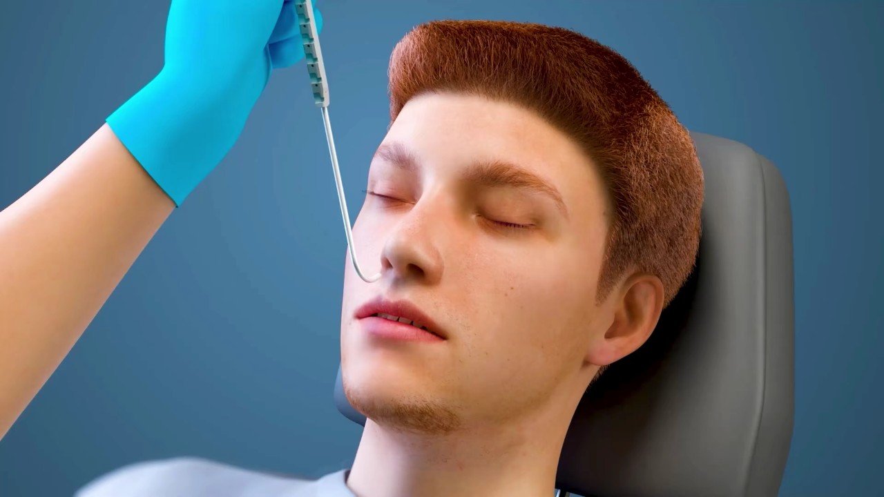 Frame from Nasal Foreign Body Removal
